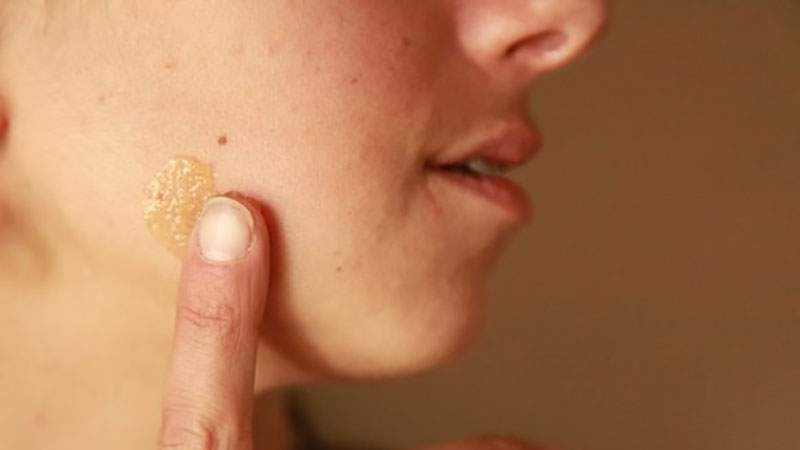 تحقیقات محققان مرتبط با درمان زخم های پوستی با عسل