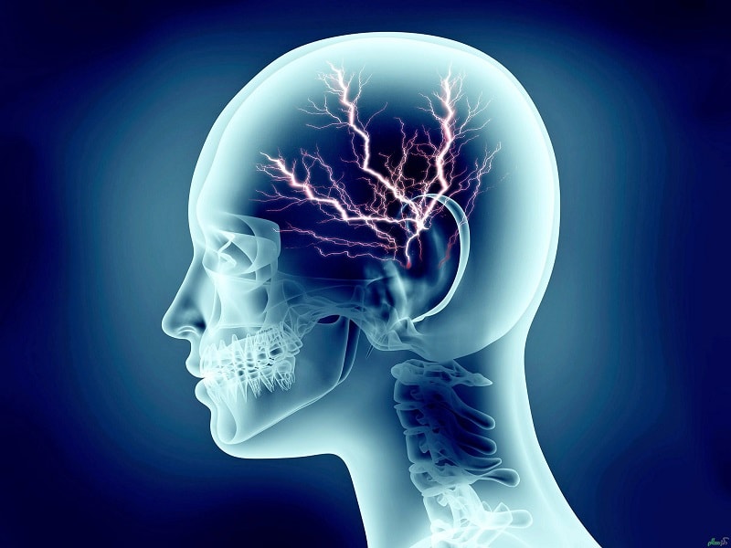 درمان بیماری های عقلی و هوشی: ضعف حافظه (باقری)