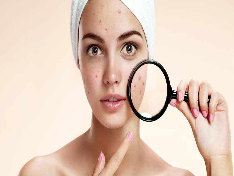 درمان بیماری ها در طب سنتی ، پوست و مو