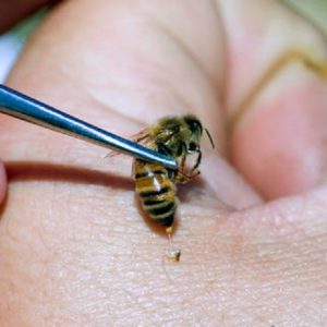 لوازم مورد نیاز برای زنبور درمانی