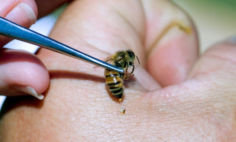 لوازم مورد نیاز برای زنبور درمانی