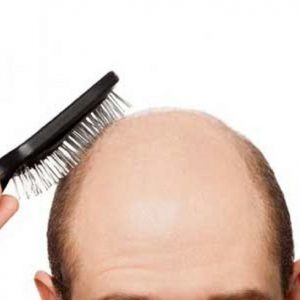 درمان کچلی سر و تقویت مو و ابرو