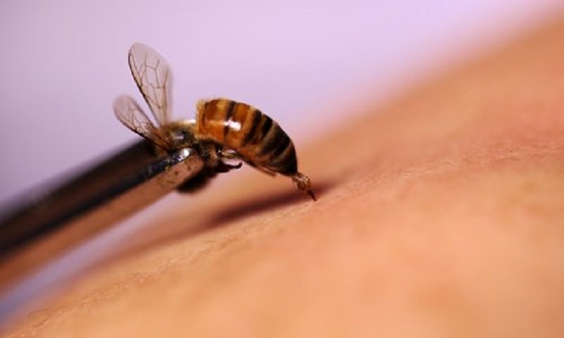 زنبور درمانی 