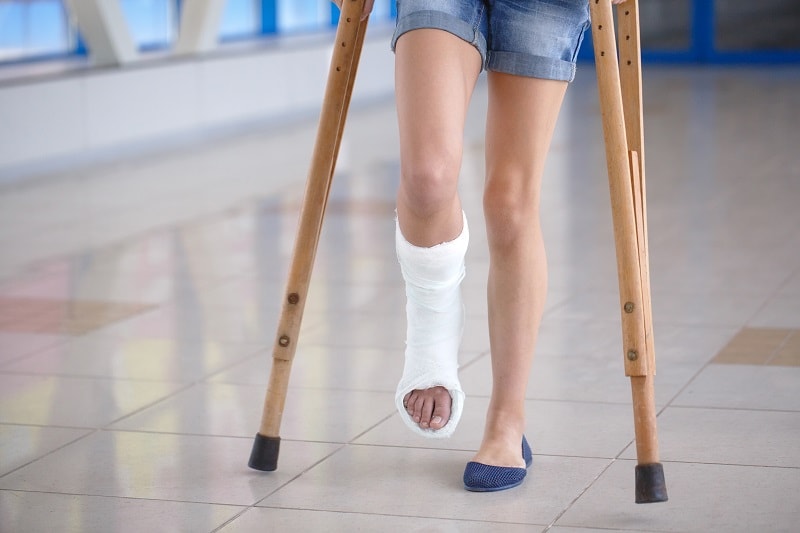 دختری که یکی از پاهایش شکسته که نقش ویتامین ها در رشد استخوان ها و استحکام آن ها را نشان می دهد.