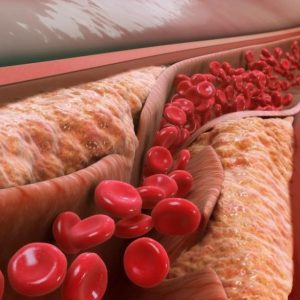 کاهش کلسترول خون با ژل رویال
