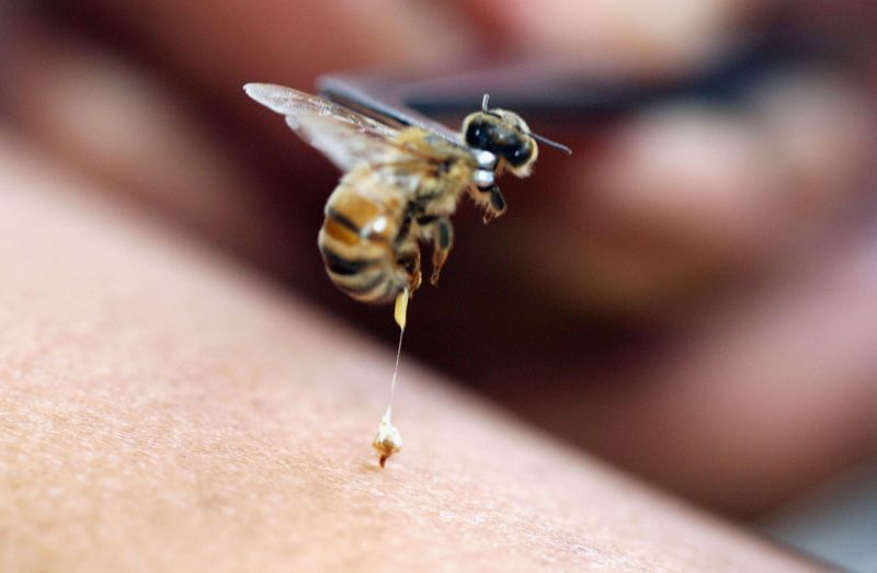 آمپول زهر زنبور عسل برای درمان بیماری ها
